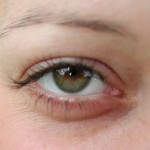 eye-open